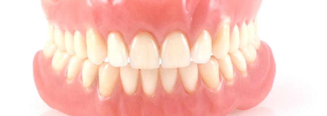 A complete set of dentures in Monroe.