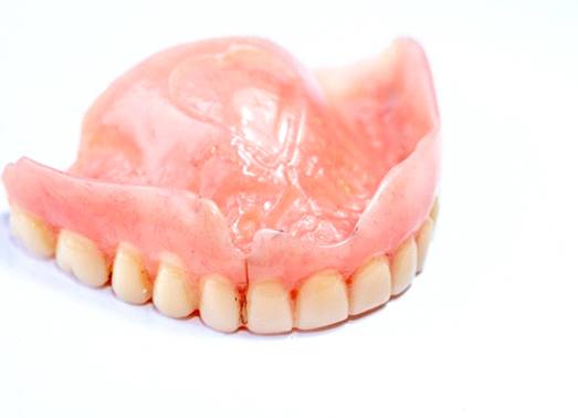 A fractured denture.