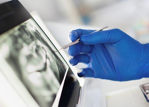 Dentist looking at digital x-rays on chairside computer