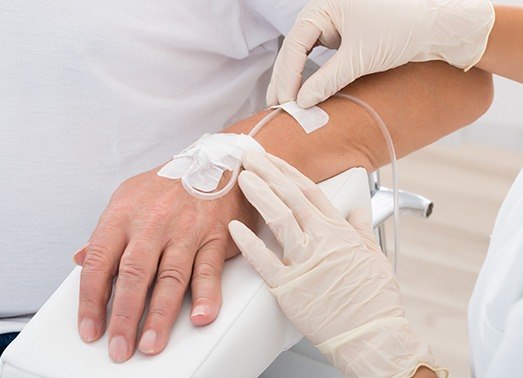 IV dental sedation drip in patient's arm