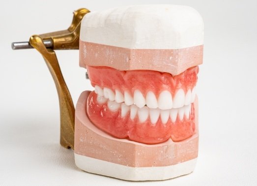 Full dentures on smile model